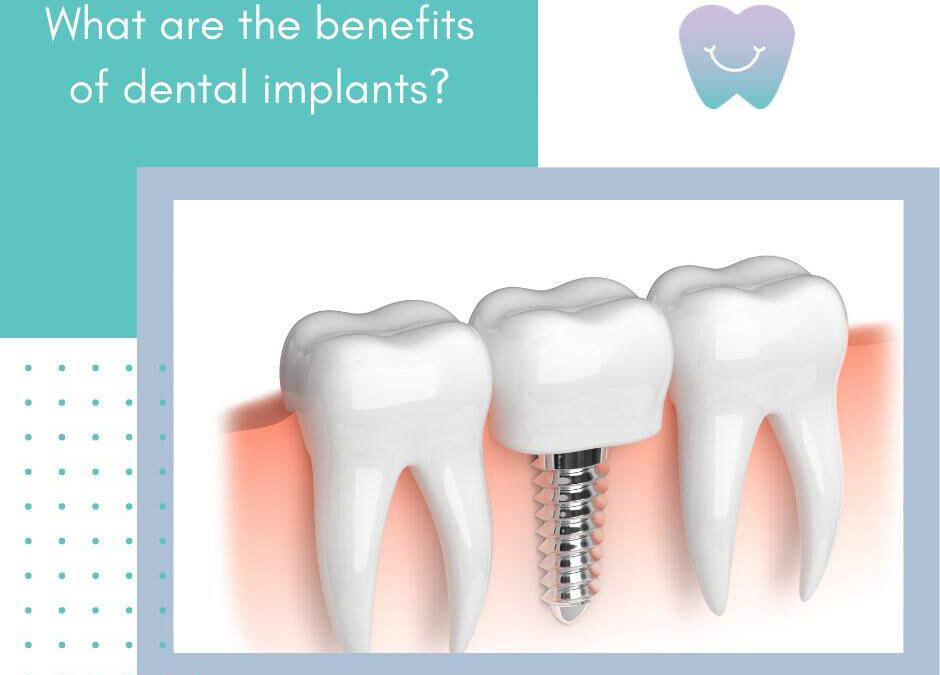 Rediscover Your Smile with Crowns and Bridges in Santa Clarita