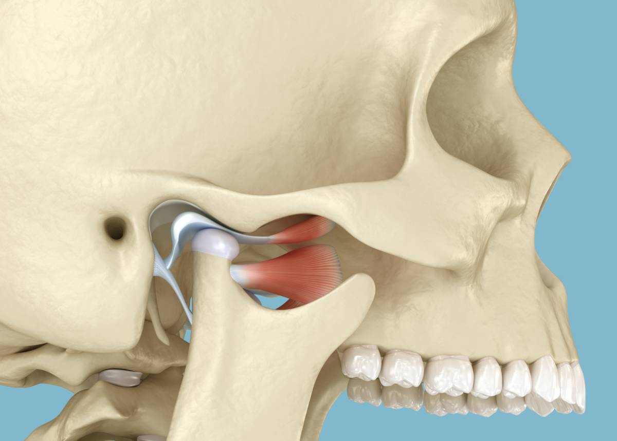 TMJ Treatment
