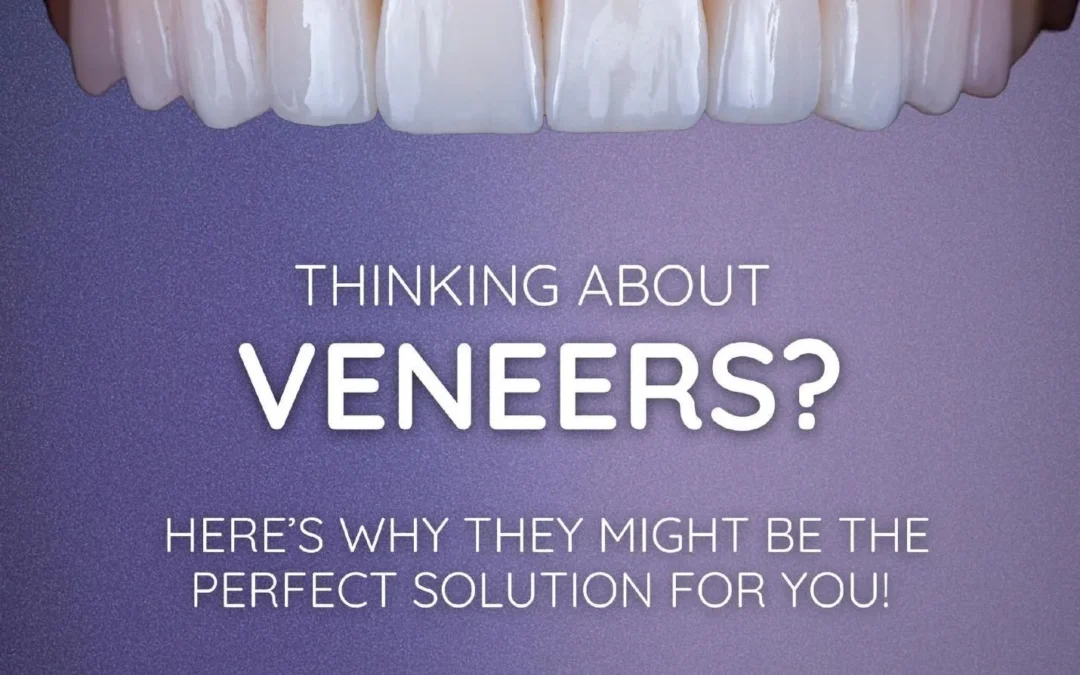 Veeners