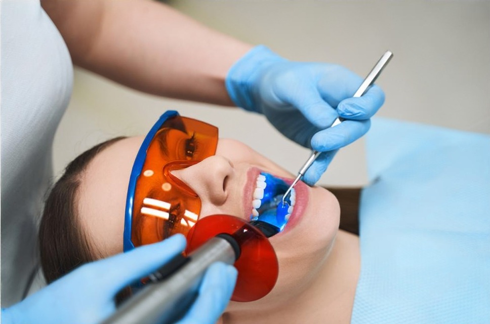 Brighten Your Smile: Discover the Top Benefits of Professional Teeth Whitening at Skyline Smiles